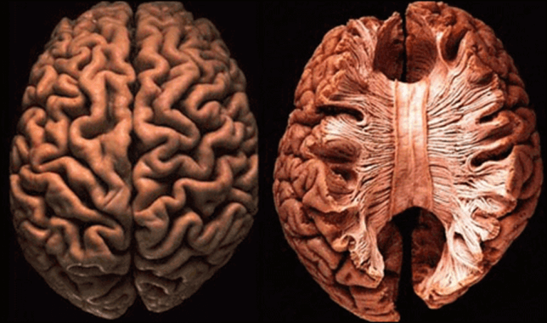 Anatomia do Cérebro corte