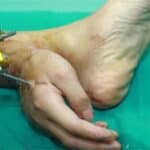 Incríveis partes do corpo re-implantadas em cirurgias